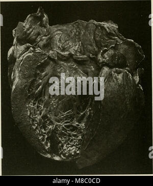 Erkrankungen der Brust und der Prinzipien der physischen Diagnose (1920) (14594015238) Stockfoto