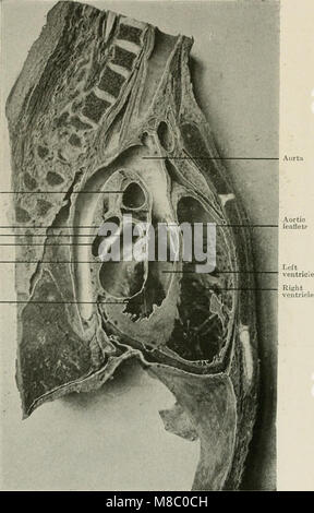 Erkrankungen der Brust und der Prinzipien der physischen Diagnose (1920) (14757589656) Stockfoto