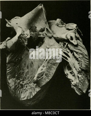 Erkrankungen der Brust und der Prinzipien der physischen Diagnose (1920) (14780651375) Stockfoto