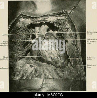 Erkrankungen der Brust und der Prinzipien der physischen Diagnose (1920) (14799900833) Stockfoto