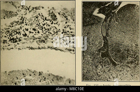 Erkrankungen des Nervensystems - ein Lehrbuch der Neurologie und Psychiatrie (1915) (14596126669) Stockfoto