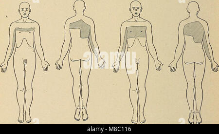 Erkrankungen des Nervensystems - ein Lehrbuch der Neurologie und Psychiatrie (1915) (14596230039) Stockfoto