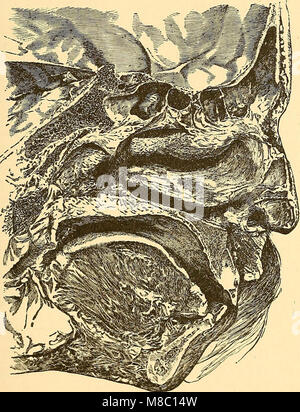 Erkrankungen der Nase und des Rachens; ein Lehrbuch für Studenten und Praktiker (1893) (14782378835) Stockfoto