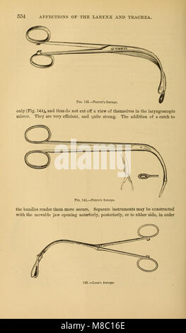 Erkrankungen des Rachens und der Nase; ein Leitfaden für die Diagnostik und Behandlung von Erkrankungen des Rachens, sophagus, Luftröhre, Kehlkopf, und Nares (1879) (14775972422) Stockfoto