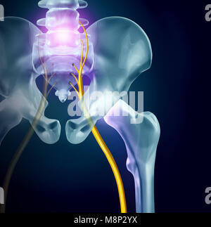 Ischias Schmerzen, Symptome und Diagnose medizinisches Konzept als Krankheit verursacht körperliche Probleme mit 3D Illustration Elemente Stockfoto