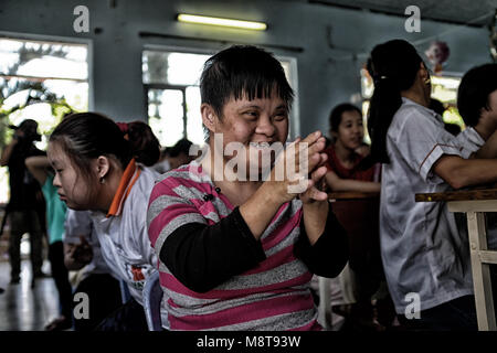 Agent Orange Opfer in Vietnam. Stockfoto