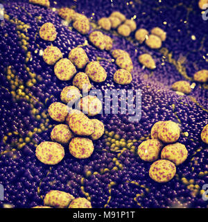 Kolonie von Staphylococcus aureus-Bakterien verursacht, Hautinfektion, Antibiotika-resistente Infektionskrankheiten Stockfoto