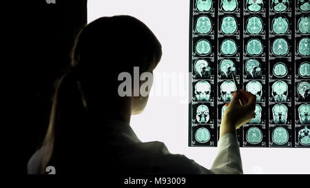 Neurochirurg am Patienten Gehirn x-ray suchen, zeigen Bild, Krankenhaus Praktikum Stockfoto