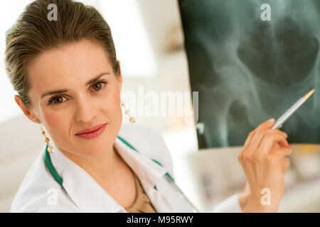 Arzt Frau zeigt auf fluorography Stockfoto