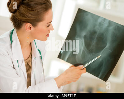 Arzt Frau zeigt auf fluorography Stockfoto