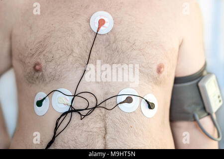 Holter Gerät überwachen und tägliche Blutdruck Recorder auf den männlichen Körper. Tägliche Elektrokardiogramm Überwachung. Übergewichtige Person. Hohes Risiko von kardialen Erkrankungen. Gesundheitsversorgung und Prävention Stockfoto