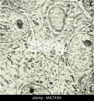 . Elektronenmikroskopie; Verfahren der Konferenz von Stockholm, September, 1956. J*^*. 9^ Abb. I. in der Schilddrüse von einem 9 Tage alten Embryo. Die Stopfbuchse wird von einem cordonal Art und Zellen sind praktisch ohne canalicu-lar Strukturen und Kolloid. Mitochondrien und kleinen Vakuolen sind sichtbar. Vergrößerung 5000. Und Küken von 8 Tagen Brutzeit bis 13 Tage nach dem Schlüpfen (Sussex). Schilddrüsen wurden auch entfernt von 18 Embryonen von 9 und 16 Tage vorher an 3 Tagen mit Thyroxin (0,001 mg) oder tetramethylthiourea (1,5 mg) behandelt. Auswahl und Dosierung der Medikamente wurden von unserem vorherigen inv etabliert Stockfoto