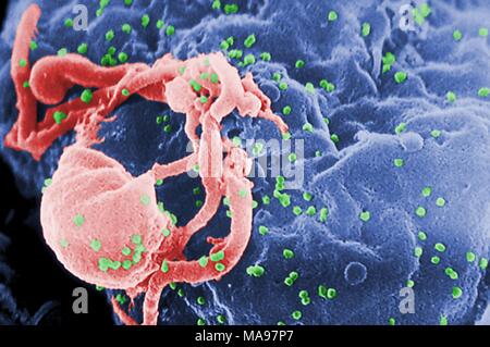 Scanning Electron Micrograph (SEM) der HIV-1-virionen als grüne runde Beulen angehende von der Oberfläche eines kultivierten Lymphozyten Zelle, 1985. Mit freundlicher CDC/C. Goldschmied, S. Feorino, E.L. Palmer, W.R. McManus. () Stockfoto