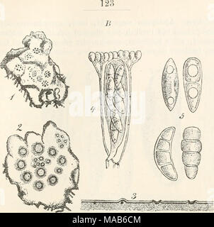 . Dr. L. Rabenhorst der Kryptogamen-Flora von Deutschland, Oesterreich und der Schweiz. B. in Abb. 1 - 5. Phragmonaevia Nylanderi. Abb. 1. Peltigera-Thallus mit dem Pilz in natürlicher Grösse (trocken). Abb. 2. Ein Stück Abb. mit Apothecien Abb. 3. Querschnitt durch Apothecien. Abb. 4. Schlauch mit paraphysen. Abb. 5. Sporen. (Abb. 2 He. 3 massig, Abb. 4 He. 5 stark vergrössert. Sämratlich Original - Zeichnungen nach der Natur). Stockfoto