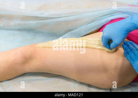 Prozess der Beine enthaaren mit Zucker für Frauen in einem Schönheitssalon. Stockfoto