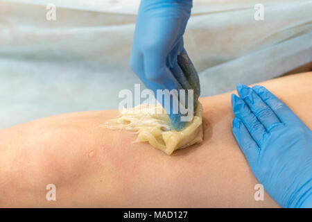 Prozess der Beine enthaaren mit Zucker für Frauen in einem Schönheitssalon. Stockfoto