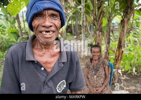 HealthcareA Mann und Frau im Dorf Kasait, Liquica, Timor Leste. Wegen der fehlenden Infrastruktur in den Bergen, den Zugang zur Gesundheitsversorgung für die Dorfbewohner ist schwierig, und es gibt eine weit verbreitete Unterernährung. Dieser Mann ist auch seine Zähne zu verlieren, da gibt es keine zahnmedizinische Einrichtungen. Stockfoto