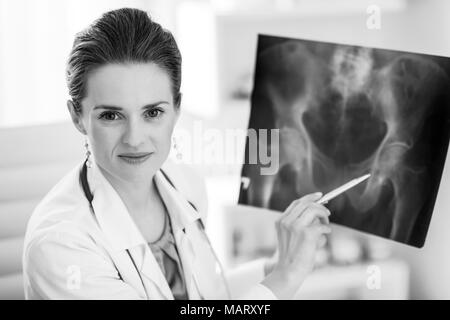 Porträt der Arzt Frau zeigt auf fluorography Stockfoto