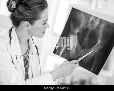 Arzt Frau zeigt auf fluorography Stockfoto