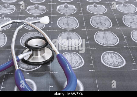 Perspektivische Ansicht eines MRT-Scan des Gehirns (transversale Ansicht) und einem blauen Stethoskop Stockfoto