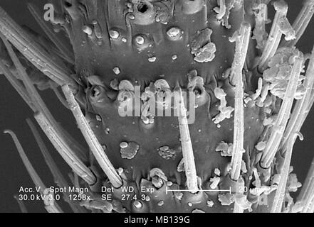 Bein eines nicht identifizierten Grünes fliegendes Insekt in Decatur, Georgia, in der 1258 x ergab vergrößerte Rasterelektronenmikroskopische (SEM) Bild, 2005. Mit freundlicher Seuchenkontrollzentren (CDC)/Janice Haney Carr. () Stockfoto