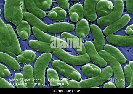 Gruppierung von Vibrio vulnificus Bakterien im 13184 x offenbart vergrößerte Rasterelektronenmikroskopische (SEM) Bild, 2005. Mit freundlicher Seuchenkontrollzentren (CDC)/Koloriert von James Gathany. () Stockfoto