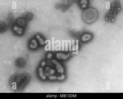 Influenza-A-Virus in der Raster-Elektronen-Mikroskop (REM) Bild, 1978 aufgedeckt. Mit freundlicher Seuchenkontrollzentren (CDC). () Stockfoto