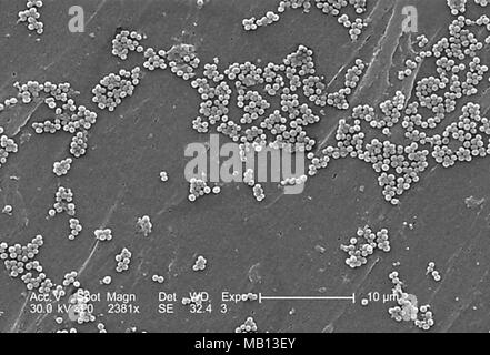 Klumpen von Methicillin-resistenten Staphylococcus aureus-Bakterien (MRSA) in der 2381 x offenbart vergrößerte Rasterelektronenmikroskopische (SEM) Bild, 2005. Mit freundlicher Seuchenkontrollzentren (CDC)/Janice Haney Carr, Jeff Hageman-faktor. () Stockfoto