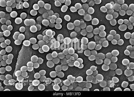 Klumpen von Methicillin-resistenten Staphylococcus aureus-Bakterien (MRSA) in den 9560x offenbart vergrößerte Rasterelektronenmikroskopische (SEM) Bild, 2005. Mit freundlicher Seuchenkontrollzentren (CDC)/Janice Haney Carr, Jeff Hageman-faktor. () Stockfoto