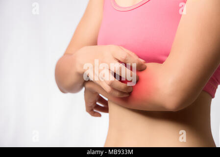 Junge Frau mit der rechten Hand und kratzen Ausschlag an den linken Arm auf weißem Hintergrund Stockfoto