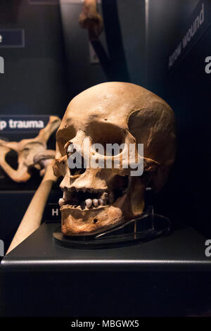 Menschliche Schädel aus Wrack der Mary Rose; Kriegsschiff der englischen Tudor navy von König Henry VIII. Die Mary Rose Museum, Historic Dockyard, Portsmouth. Großbritannien Stockfoto