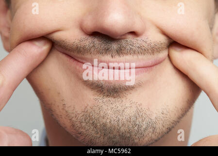 Fake Lächeln schließen bis auf männliche Gesicht mit Bart gezwungen Stockfoto