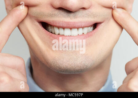 Die gefälschten Lächeln mit Zähne und Finger Nahaufnahme Stockfoto
