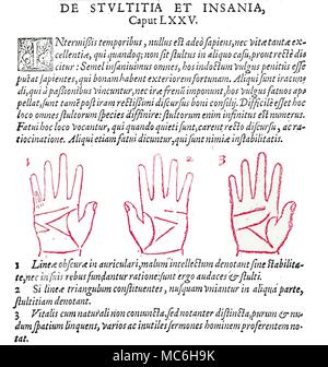 Handlesen Beispiel spätmittelalterlicher Handlesen - drei Diagramme mit der Darstellung der Beziehung der drei wichtigsten Linien in Bezug auf dumm und verrückte Menschen. Von Johannes Taisniers, Absolutissimae Chyromantiae, 1632. [Bild links] das schwache Linien laufen die unteren Phalanx der unteren Finger als ein Zeichen für eine schlechte Intellekt berücksichtigt wird. [Mittlere Diagramm] Wenn die drei Linien, die Form der Triangulum der Hand nicht erfüllen, dann wird diese als ein Zeichen für eine dumme Person berücksichtigt wird. [Diagramm rechts], wenn die Oberseite der Life Line nicht mit der Kopfleiste, die einzelnen gegeben ist sinnlos speec Stockfoto