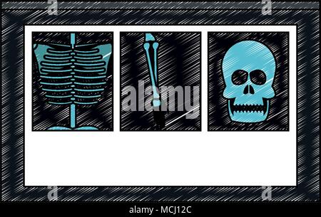 Xray Knochen Bilder scribble Stock Vektor