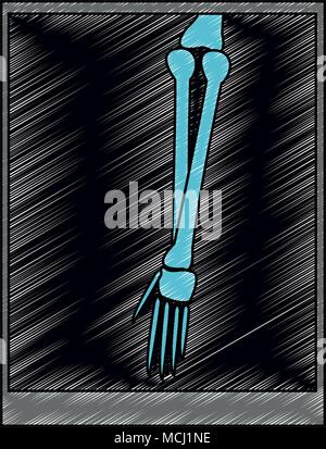 Xray Knochen Bilder scribble Stock Vektor