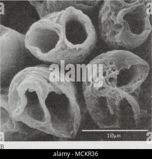 . Abbildung 6 REM-Aufnahmen von Botryococcus zeigen die offene Struktur des Cups in der Organismen (mit der äußeren Kanten in die Platte 1, F vergleichen). Mazeriert Exemplare auf millipore Filterpapier und sind bei Vergrößerungen von l, 250x (A) und 3.700 x (B). bekannt durch mikroskopische Untersuchungen an lebenden Botryococcus (Niklas und Phillips 1974). Es ist noch nicht vollständig verstanden, warum diese Tassen so gut trotz in bituminöse Kohlen, deren ursprüngliche organische - reiche peats machte drei- bis 10-fache Compac- während ihrer Metamorphose zu Kohle (Kosanke et al gefunden werden konserviert worden sind 1958, Stach et al. 1982). Stockfoto