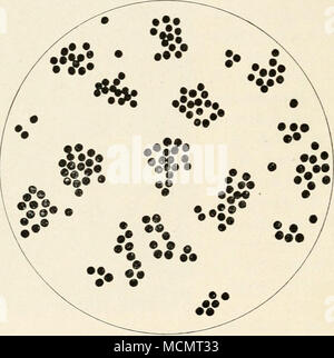 . Abb. 2. Micrococcus pyogoies Aureus. Drai^ iug von einem Deckel - Glas Vorbereitung einer Bouillon Kultur. Hochvergrößernde. Organismen, von denen bekannt ist, Wundinfektionen bei Tieren zu produzieren. In der Regel sind jedoch die auftretenden Formen sind Micro-Kokken, vor allem auch aus der Staphylokokken, Streptokokken, Bazillus pyogenes (Bacillus pyogenes Bovis (Grips) Bacillus pyogenes suis (Kiinnemann)), ein paar andere Bazillen, vor allem auch aus dem Doppelpunkt Gruppe und einige Arten der Gattung Pseudomonas. Pilze und Protozoen Stockfoto