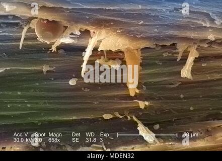 Morphologische Merkmale Der domestizierte Katze (Felis domesticus) gestochen scharfe Krallen, in der stark vergrösserten Rasterelektronenmikroskopische (SEM) Bild 2005 aufgedeckt. Mit freundlicher Seuchenkontrollzentren (CDC)/Janice Haney Carr. Hinweis: Das Bild hat digital über ein modernes Prozess eingefärbt worden. Farben können nicht wissenschaftlich korrekt sein. () Stockfoto