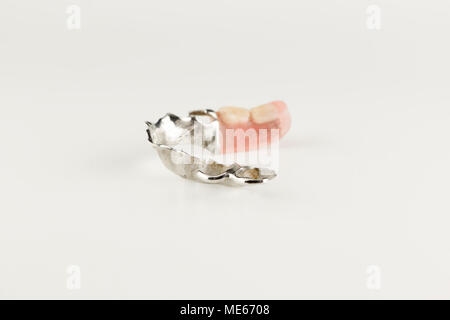 Arc Zahnersatz für Patienten mit partieller Verlust der Zähne Stockfoto