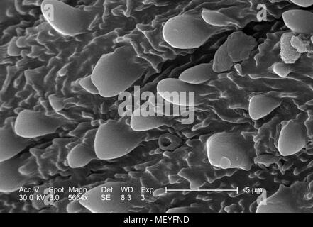 Ornamental geschmückt exoskeletal Oberfläche von einem unbekannten Insekt im 5664 x offenbart vergrößerte Rasterelektronenmikroskopische (SEM) Bild, 2005. Mit freundlicher Seuchenkontrollzentren (CDC)/Janice Haney Carr. () Stockfoto