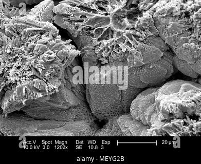 Morphologische Merkmale der inneren Oberfläche eines nicht identifizierten Vögeln Eierschale, in der 1202 x vergrößert Rasterelektronenmikroskopische (SEM) Bild 2005 dargestellt. Mit freundlicher Seuchenkontrollzentren (CDC)/Janice Haney Carr, Sandra L. Westmoreland, an der Universität von Texas in Arlington. () Stockfoto