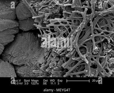 Morphologische Merkmale der inneren Oberfläche eines nicht identifizierten Vögeln Eierschale, in der 1227 x vergrößert Rasterelektronenmikroskopische (SEM) Bild 2005 dargestellt. Mit freundlicher Seuchenkontrollzentren (CDC)/Janice Haney Carr, Sandra L. Westmoreland, an der Universität von Texas in Arlington. () Stockfoto