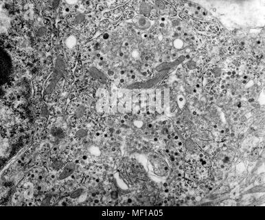 Gewebeschnitt mit Rift Valley Fieber (RVF) Virus in das hochvergrössernde Getriebe Elektronenmikroskopischen (TEM) Bild, 1980 deckte infiziert. Mit freundlicher Seuchenkontrollzentren (CDC)/F.A. Murphy, J. Dalrymple. () Stockfoto