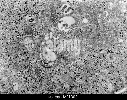 Gewebeschnitt mit Rift Valley Fieber (RVF) Virus in das hochvergrössernde Getriebe Elektronenmikroskopischen (TEM) Bild, 1980 deckte infiziert. Mit freundlicher Seuchenkontrollzentren (CDC)/F.A. Murphy, J. Dalrymple. () Stockfoto