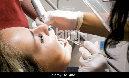 Closeup Image der jungen Frau öffnet den Mund beim Zahnarzt clening Zähne Plakette Stockfoto