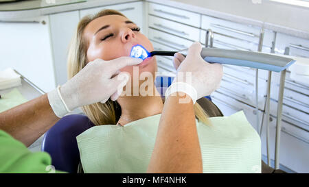 Zahnarzt mit Dental curing UV-Lampe für die Behandlung Stockfoto