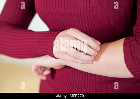 Nahaufnahme von Frau mit Haut Beschwerde Kratzen Arm Stockfoto
