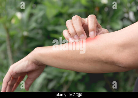 Frauen scratch itch mit Hand. Frau Kratzer auf ihrem Arm healthcare Konzept. Stockfoto