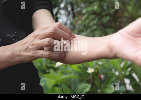 Frauen scratch itch mit Hand. Frau Kratzer auf ihrem Arm healthcare Konzept. Stockfoto